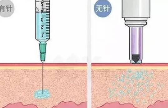 无针注射来了!儿童们或将告别“打针噩梦”