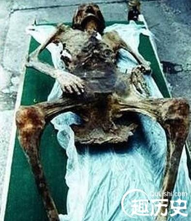 600年古尸产下活婴！怀孕古尸女婴仅存活72小时